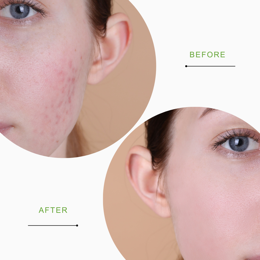 SWASCO NIROLI POWDER FACE WASH - NATURAL RADIANCE AND DEEP CLEANSING SWASTIK COSMETICS