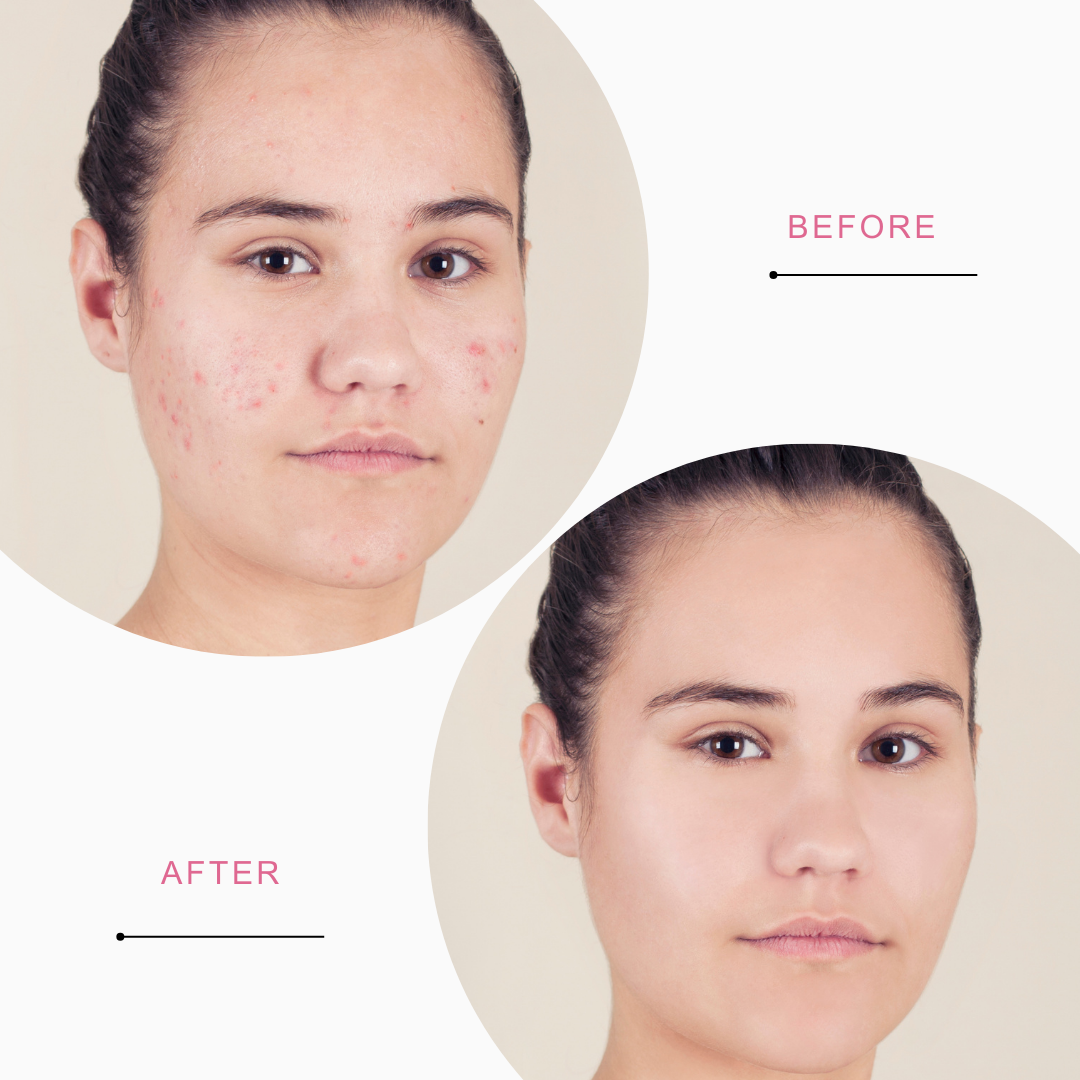 SWASCO ROSE & NIACINAMIDE ACID POWDER FACE WASH - ANTI-ACNE SWASTIK COSMETICS