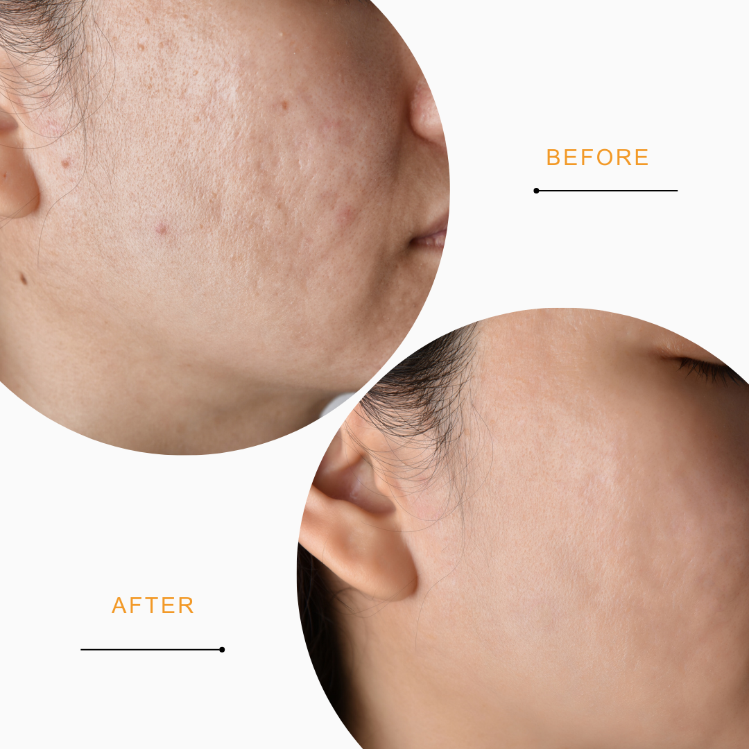 SWASCO ORANGE & SALICYLIC ACID POWDER FACE WASH - EFFECTIVE PORE REDUCTION SWASTIK COSMETICS