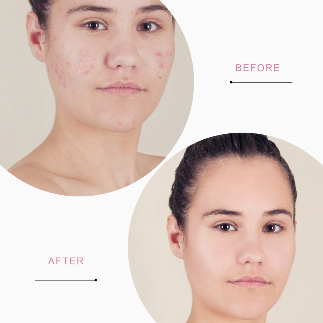 SWASCO HYALURONIC ACID & WATERMELON POWDER FACE WASH - DEEP HYDRATION AND REFRESHING GLOW SWASTIK COSMETICS